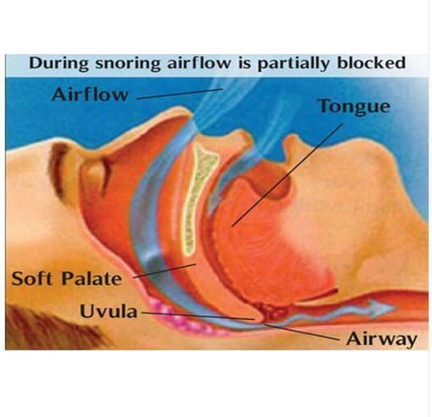 Image of Professional Anti Snoring Device Anti Snore Nose Clip Relieve Snoring Snore Stopping Health Care For Men Women