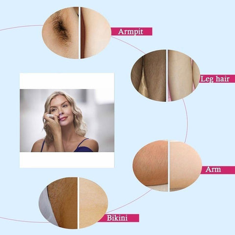 Image of Flawless Hair Remover