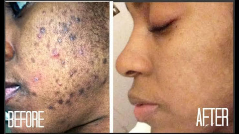 Image of Herbal Black Soap For Glowing And Shining Skin