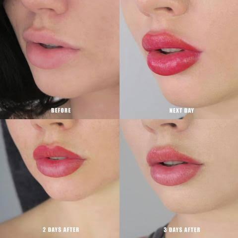 Image of LUXURY LIPS PEEL OFF MASK PINK AND RED (2 IN A PACK)